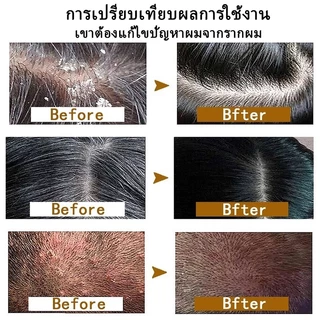 ✅SAFEMILD แชมพู สูตรเฮอร์บัล มายด์ ปิดผมหงอกอย่างมีประสิทธิภาพ ลดผมร่วง บำรุงและซ่อมแซมเส้นผม