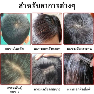 ✅SAFEMILD แชมพู สูตรเฮอร์บัล มายด์ ปิดผมหงอกอย่างมีประสิทธิภาพ ลดผมร่วง บำรุงและซ่อมแซมเส้นผม