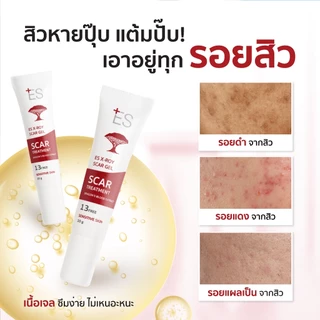 [แพ็กคู่สุดคุ้ม] ES X-roy Scar Gel 10g เจลลดรอยสิว รอยแดง รอยดำ รอยแผลเป็นจากสิว