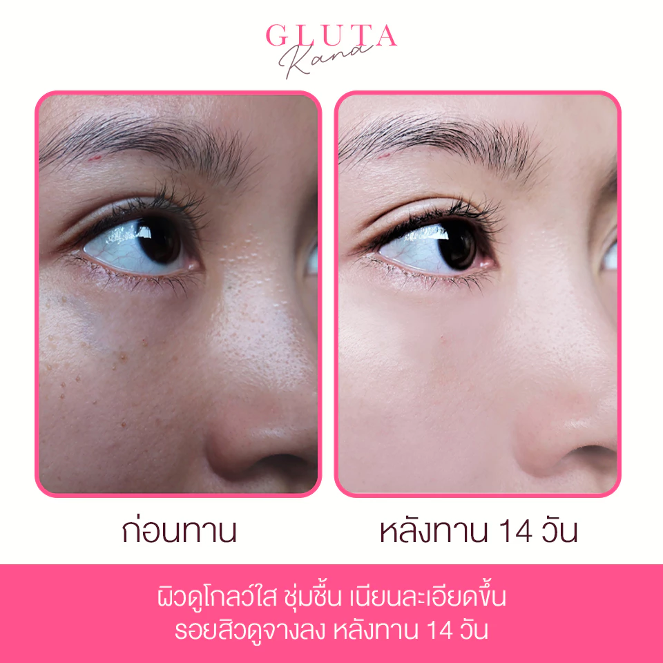 Gluta Kana กลูต้า บำรุงผิว 1 ซอง thumbnail 9