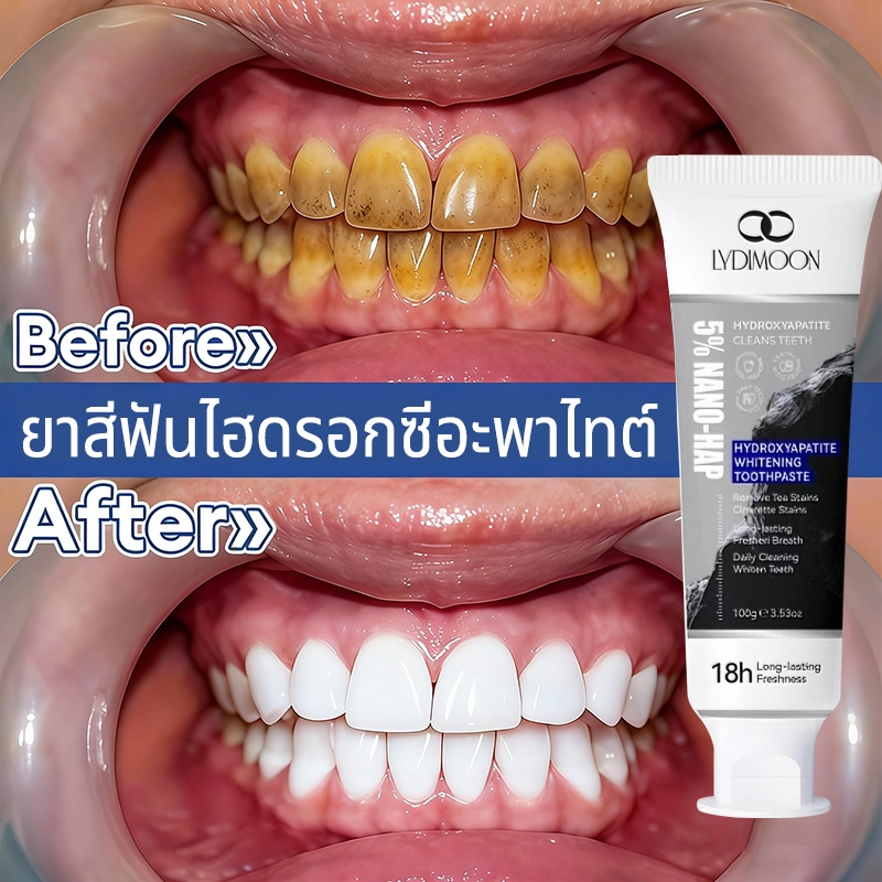 LYDIMOON ยาสีฟันไฮดรอกซีอะพาไทต์ ยาสีฟันฟอกฟันขาว ยาสีฟันสมุนไพร 100g ลดคราบเหลือง ฟันขาว ดับกลิ่นปา