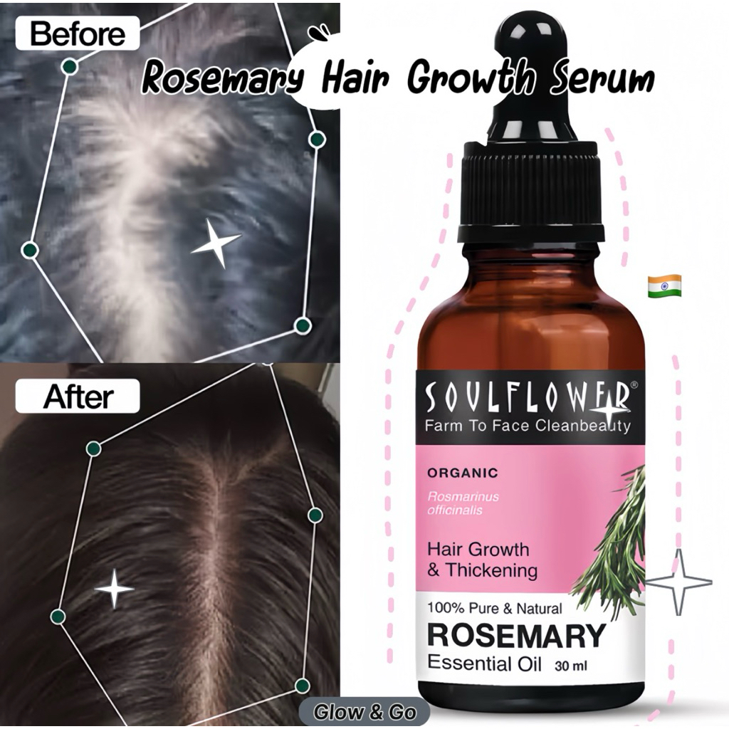 น้ำมันใส่ผม โรสแมรรี่Soulflower Rosemary Hair Growth Serum, Essential Oil30ml