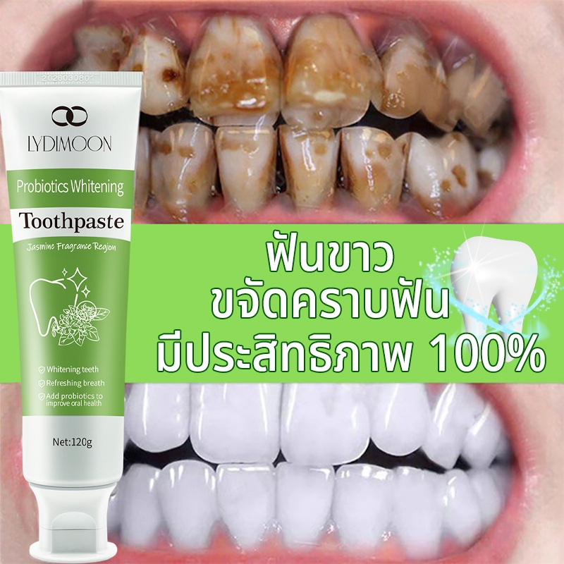 LYDIMOON ยาสีฟันฟอกฟันขาว ยาสีฟันฟันขาว ยาสีฟัน 120g ขจัดคราบเหลือง ฟอกฟันขาวขจัดคราบหินปูน ฟอกฟันขา