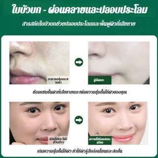 มาร์คฟองฟู่ใบบัวบก Bubble Clay Mask ฟื้นคืนผิวใส สูตรแครอทกรดเชิงซ้อน 12 ชิ้น/กล่อง รูขุมขนหดไวท์เทนนิ่ง 10 วินาทีเกิดฟอ