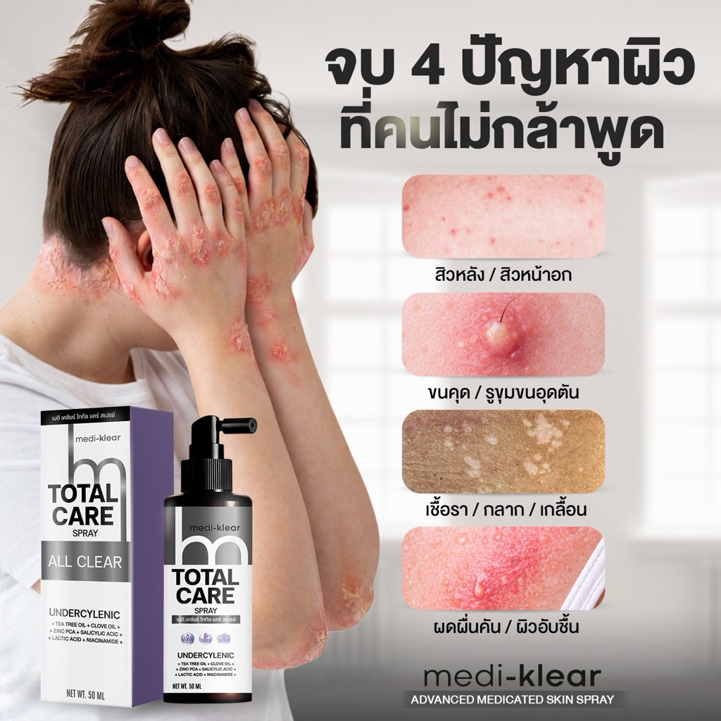 (เมดิเคลียร์) Medi-Klear สเปรย์สิวหลัง ขนคุด ผื่นคัน ผิวเชื้อรา Total Care Spray
