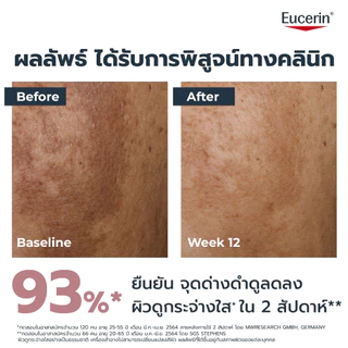 Eucerin SPOTLESS BRIGHTENING THIAMIDOL SPOT CORRECTOR 5 ML คอร์เรคเตอร์แต้มลดเลือนจุดด่างดำฝังลึก