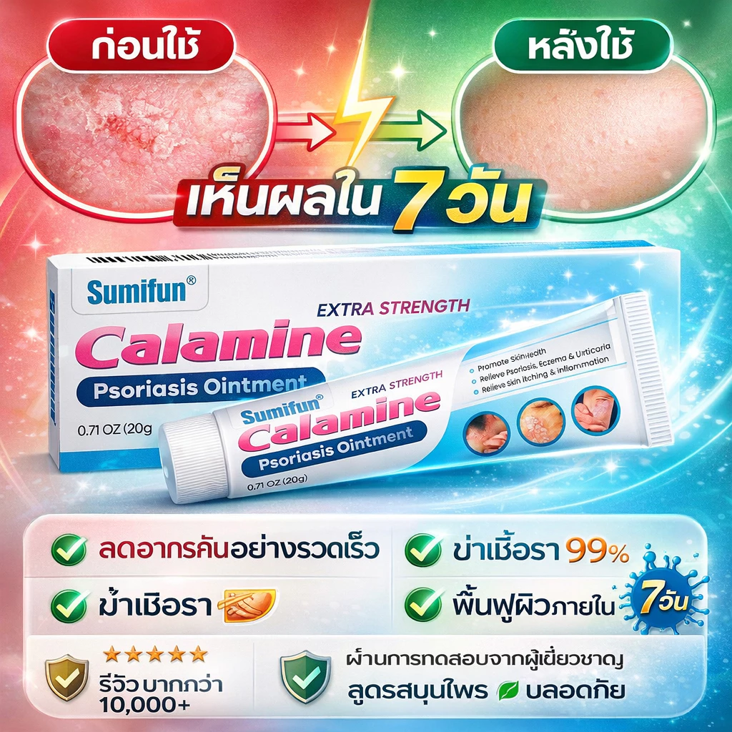 🔥[บรรเทาอาการคัน]🔥ครีมรักษาสะเก็ดเงิน ช่วยลดผื่นแดงและการลอก พร้อมฟื้นฟูสภาพผิวที่เสียหาย
