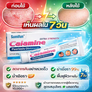 🔥[บรรเทาอาการคัน]🔥ครีมรักษาสะเก็ดเงิน ช่วยลดผื่นแดงและการลอก พร้อมฟื้นฟูสภาพผิวที่เสียหาย