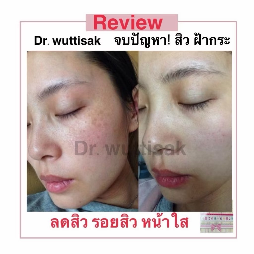 [แบบกล่อง5ชิ้น] ครีมwuttisak [เลือกสินค้าจริงในตัวเลือก]