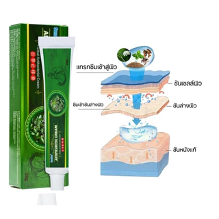 ครีมแก้คันผิว ลดผื่นคัน บรรเทาอาการคัน ฆ่าเชื้อรา ฟื้นฟูผิว เห็นผลไว 20G