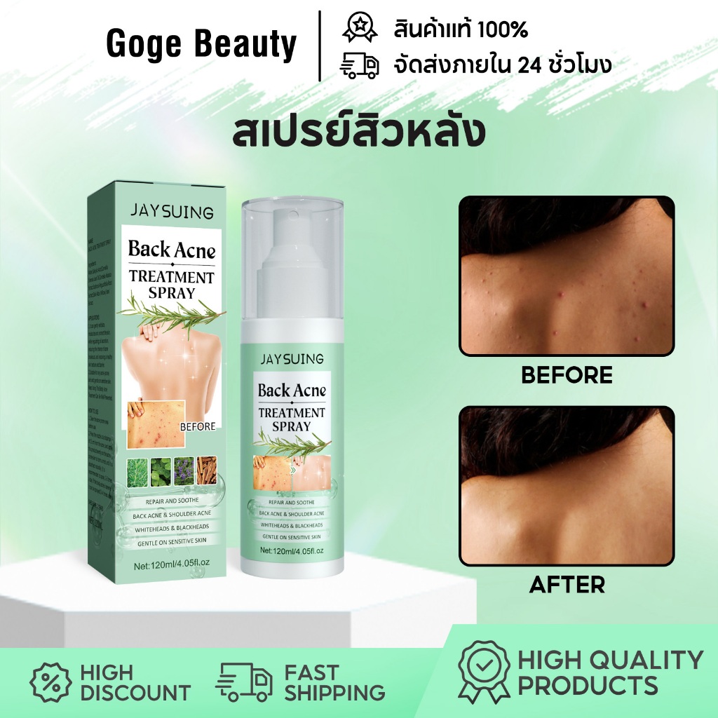 Jaysuing สเปรย์สิวหลัง Back Acne Spray 120ml กำจัดสิวที่หลังและลำตัว สเปรย์สิว ครีมแต้มสิว