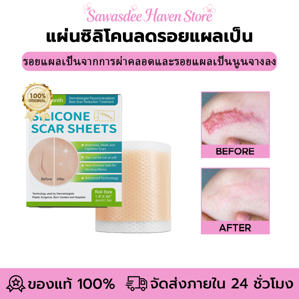 West&Month  รักษารอยแผลเป็น แผ่นแปะแผลเป็น กําจัดรอยแผลเป็นจากแผลเป็น เผยผิวเนียนสวย silicone scar sheet