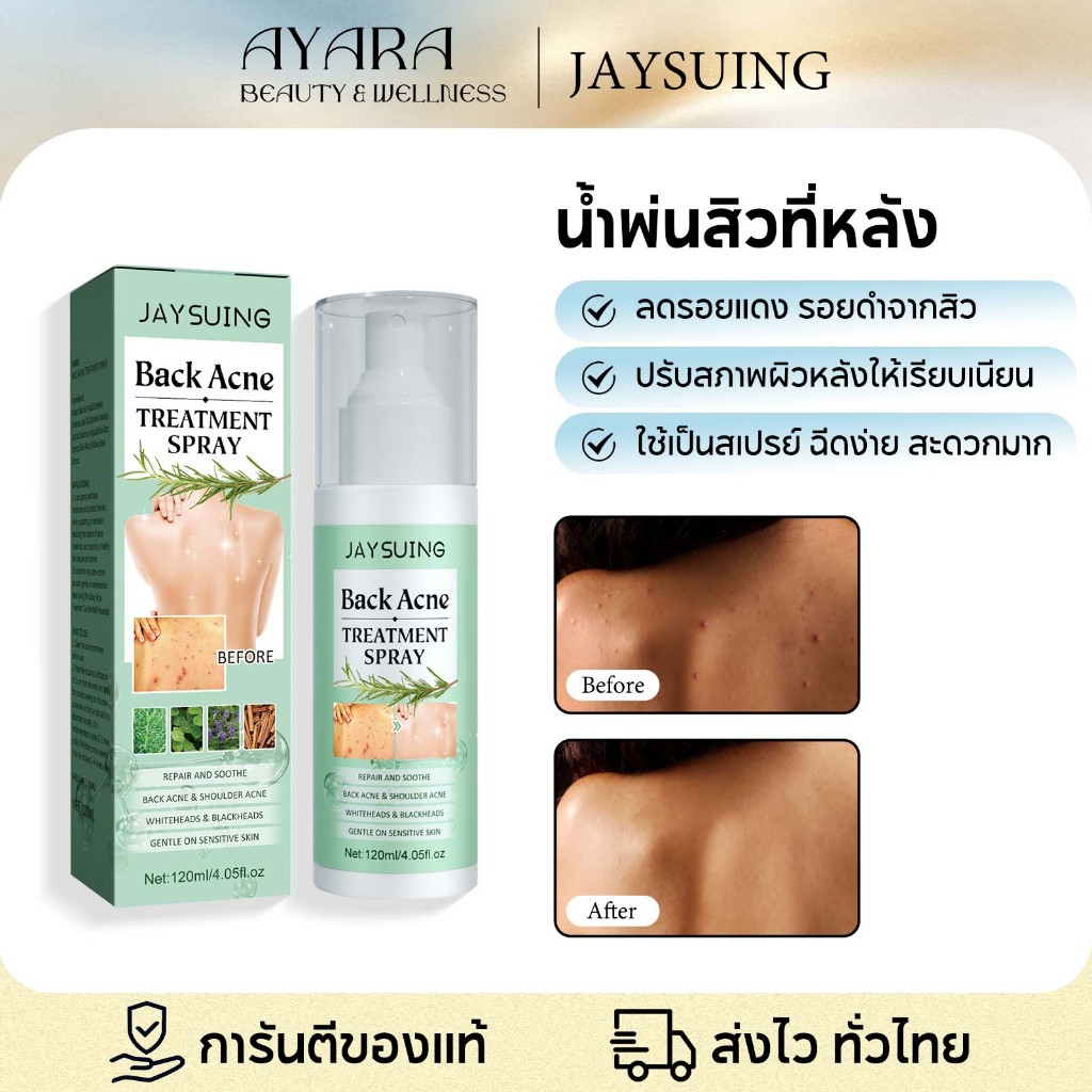 Jaysuing สิวที่หลัง แอคเน่ สเปรย์ฉีดสิว สเปรย์ฉีดแผ่นหลังและลำตัว ฆ่าเชื้อสิว และลดการเกิดสิว ลดไรและสิวตามร่างกาย