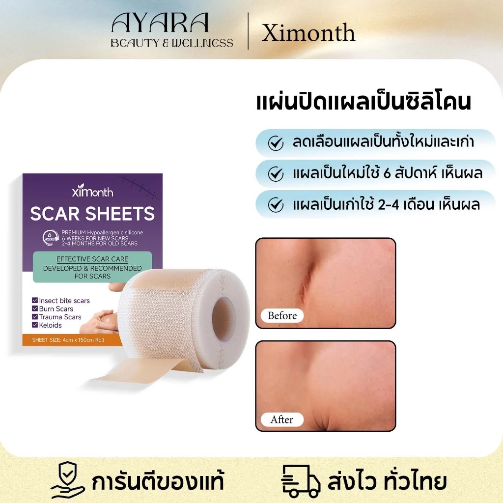 Ximonth แผ่นแผลเป็นซิลิโคน รักษารอยแผลเป็น ลดรอยแผลเป็นกําจัดรอยแผลเป็นจากแผลเป็น Silicone Scar Tape