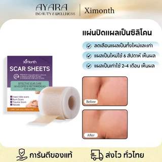 Ximonth แผ่นแผลเป็นซิลิโคน รักษารอยแผลเป็น ลดรอยแผลเป็นกําจัดรอยแผลเป็นจากแผลเป็น Silicone Scar Tape