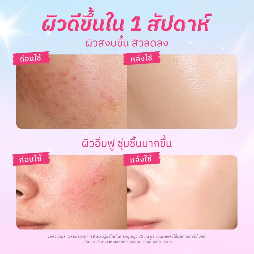 The Originote Hyalucera Moisturizer มอยส์เจอร์ไรเซอร์ เสริมสร้างเกราะป้องกันผิว ครีม ครีมทาหน้า มอยเจอร์ไรเซอร์ thumbnail 6