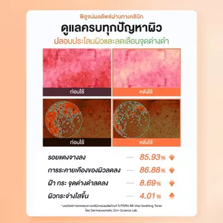 COSRX 5 PDRN B5 Vital Soothing Toner 280ml คอสอาร์เอ็กซ์ 5 พีดีอาร์เอ็น บี5 ไวทอล ซูทติ้ง โทนเนอร์