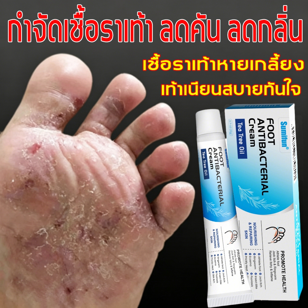 ครีมดูแลเท้าสูตรธรรมชาติ ลดกลิ่นอับ บำรุงเท้าสดชื่น ลดความแห้งและลอกผิว ซึมเร็ว ใช้ง่ายทุกวัน ต้านเชื้อแบคทีเรีย