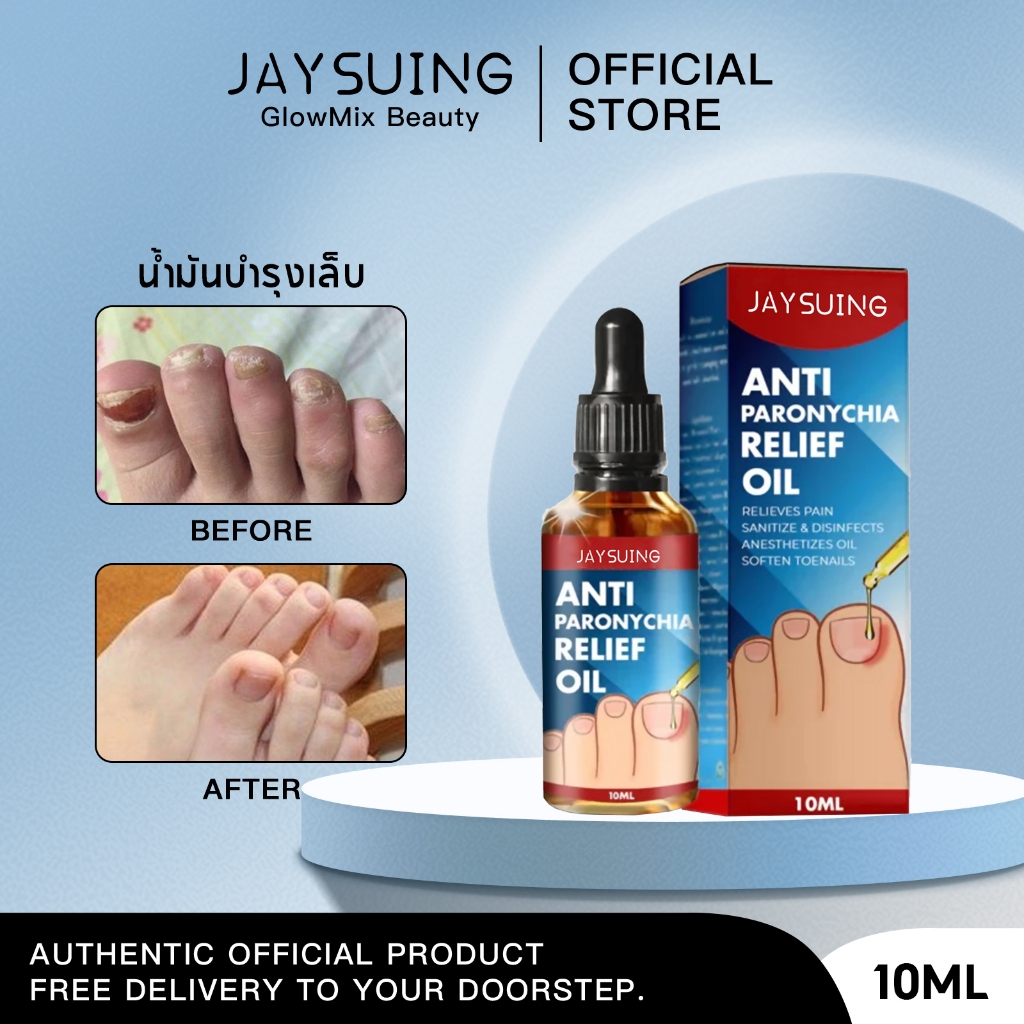 Jaysuing น้ํายาปรับเล็บขบ น้ำยาซ่อมแซมเล็บ ปรับเล็บขบ โรคติดเชื้อที่ขอบเล็บ รักษาเชื้อราที่เล็บ