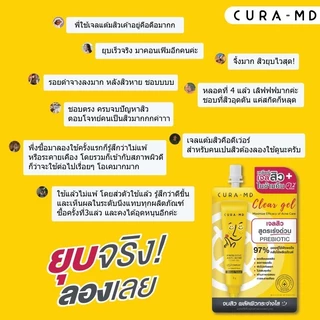 [2ซอง] CURA-MD เจลแต้มสิว สูตรเร่งด่วน สิวยุบไว ในข้ามคืน Prebiotic Anti-Acne Clear Gel 4 กรัม ช่วยให้สิวยุบไม่ทิ้งรอย