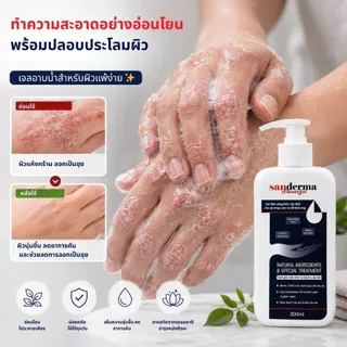 [Best Seller] เซตสบู่อาบน้ำ Sanderma 300 มล. 2 ขวด – เหมาะสำหรับผิวขนคุดและสิวหลัง