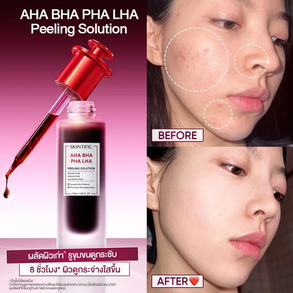 [new]SKINTIFIC AHA BHA PHA LHA PEELING SOLUTION ผลัดผิวเสีย เผยผิวดูเนียนนุ่ม รูขุมขนดูกระชับ อัพผิวดูกระจ่างใส thumbnail 7