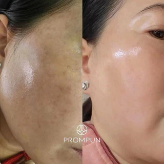 ครีมขมิ้นว่านนางแดง สูตรฝ้า กระ จุดด่างดำ ผิวกระจ่างใส กลางคืน | PROMPUN Turmeric Night Cream 5 g
