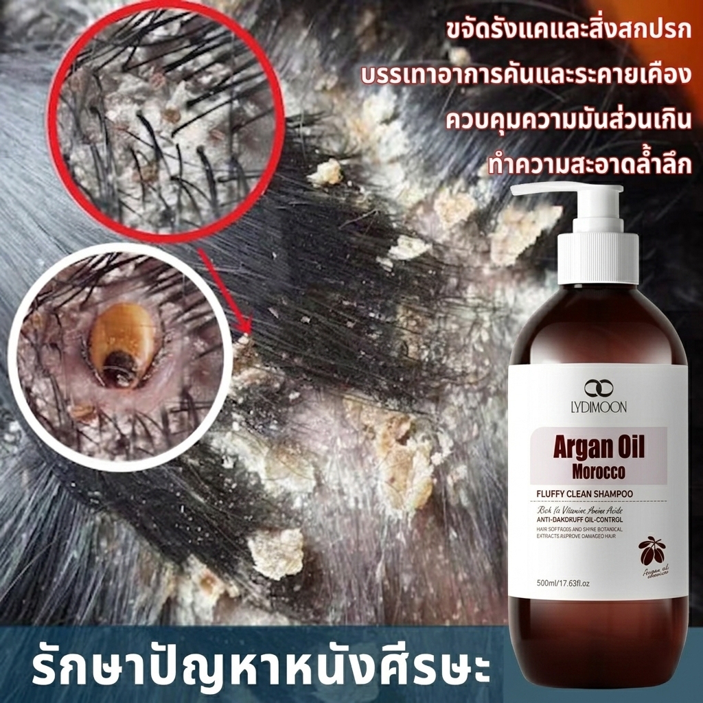 แชมพูแก้คัน ยาสระผมขจัดรังแค แชมพูรังแค 500ml ขจัดรังแค แก้คัน กำจัดไร รักษาเซบเดิร์ม ลดผมร่วง แก้รังแค แชมพู ผมมัน 500g