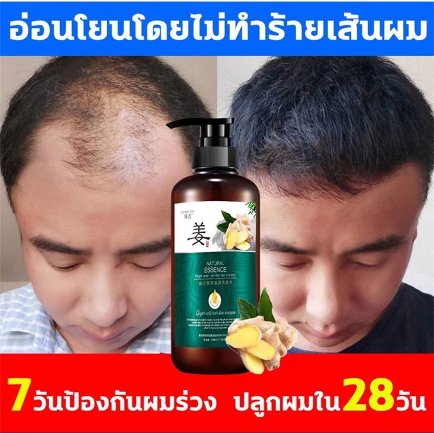 ของแท้100%🌱แชมพูขิง 500ML+ เซรั่มขิง  แก้ผมร่วงบำรุงผมและหนังศรีษะ