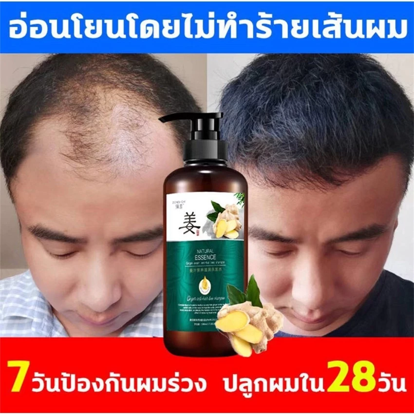 ของแท้100%🌱แชมพูขิง 500ML+ เซรั่มขิง แก้ผมร่วงบำรุงผมและหนังศรีษะ