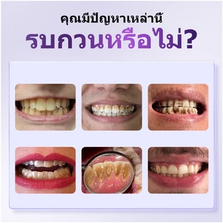YOOMU ยาสีฟันสีม่วง ดูแลช่องปากมืออาชีพ ยับยั้งแบคทีเรีย ขัดฟันขาว สดชื่นลมหายใจยาว 18 ชั่วโมง