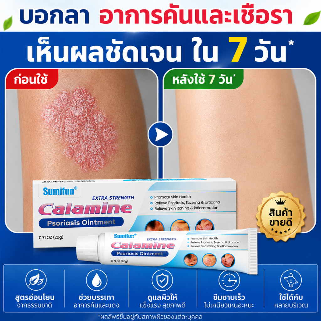 บรรเทาอาการคันและฟื้นฟู บรรเทาอาการคันอย่างรวดเร็ว ครีมต้านเชื้อราสูตรอ่อนโยน ช่วยบรรเทาอาการคันและไม่สบายผิว ซ่อมแซมผิว