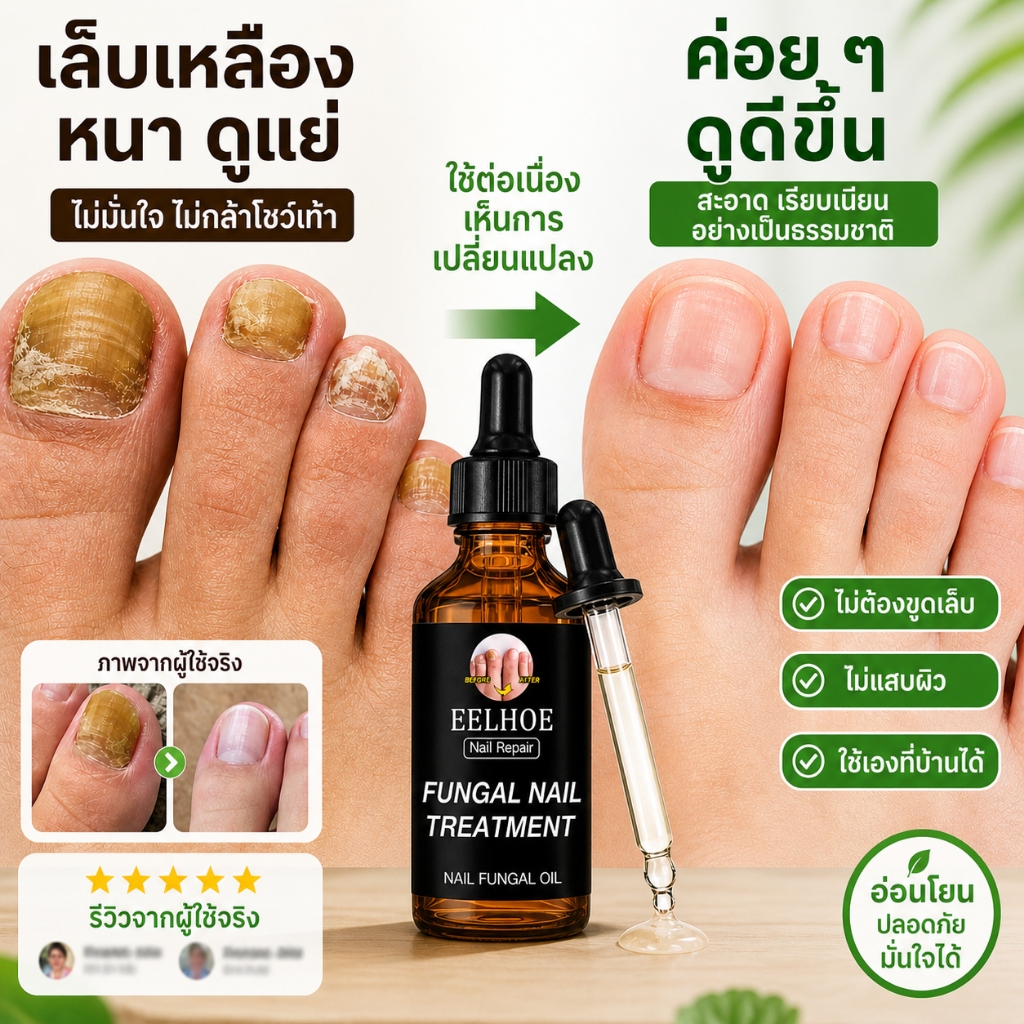 💧[ฟื้นฟูเล็บ]💧 เซรั่มบำรุงเล็บ ช่วยบำรุงลึก ฟื้นฟูเล็บที่เสียหาย ให้เล็บแข็งแรงและสุขภาพดีขึ้น