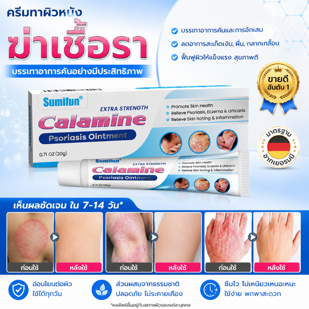 ครีมฆ่าเชื้อรา Sumifun｜รักษาสะเก็ดเงิน ผื่น คัน｜ฟื้นฟูผิวแข็งแรง สุขภาพดี｜ซึมเร็ว ไม่เหนียวเหนอะหนะ｜ส่วนผสมจากธรรมชาติ ป