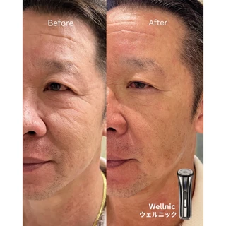 (Pre-order) Wellnic Prime Lift Advance Beauty Device เครื่องนวดหน้า เครื่องนวดยกกระชับหน้า 3 โหมด ยกกระชับ ลดริ้วรอย