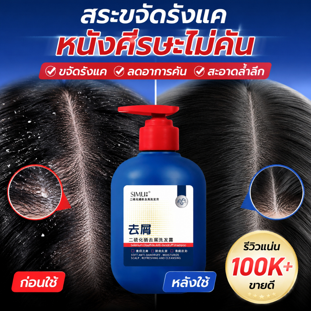 แชมพูสกัดซีลีเนียมไดซัลไฟด์ 300ml ขจัดรังแคและเชื้อรา บำบัดไรฝุ่น ควบคุมความมัน ผมนุ่มฟูสดชื่น ใช้ได้ทั้งชายและหญิง
