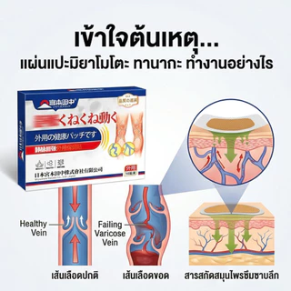 Varicose Vein Treatment Patch แผ่นแปะเส้นเลือดขอด ขาสวย ลบเส้นเลือดขอด กลับคืนสุขภาพเท้า 10ชิ้น