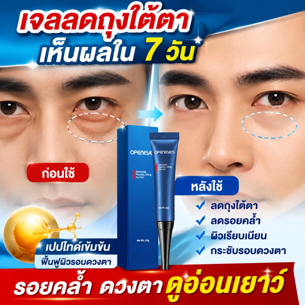 อายครีมผสานไนอาซินามายด์ 15g ยกกระชับผิวรอบตา ลดถุงใต้ตาบวมและรอยคล้ำใต้ตา