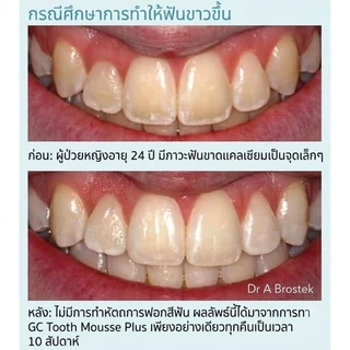 🔥 GC Tooth Mousse 40g อย.ไทย แท้100% ( ทูธ มูส กลิ่นสตอเบอรี่ ) สกัดมาจากโปรตีนในน้ำนมวัว