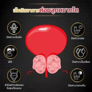NEW Mplus ผลิตภัณฑ์เสริมอาหารท่านชาย จำนวน 6 กล่อง (120 capsules) (1กล่อง/20แคปซูล)