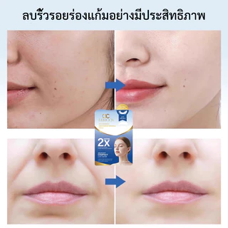 แผ่นแปะร่องแก้มลึก แผ่นมาร์คร่องแก้ม ลดริ้วรอยร่องแก้ม กระชับยกกระชับ ลบร่องลึก หน้าเด้งเรียบเนียน เทปยกกระชับผิว