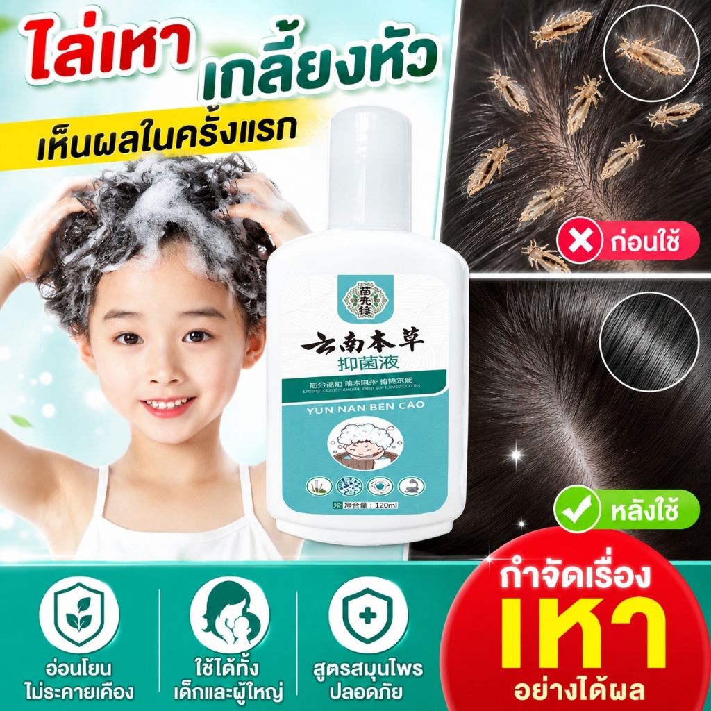 สมุนไพรออแกนิคแชมพูฆ่าเหา 120มิล กำจัดเหาไข่ถาวร ขจัดเหาได้99% ทำความสะอาดเส้นผมทั่วถึง