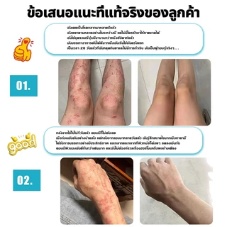 🌿 หยุดคันเร็ว ช่วยยับยั้งเชื้อรา บรรเทาอาการคันและผิวลอก เนื้อครีมบางเบา ครีมแก้เชื้อรา(18g)