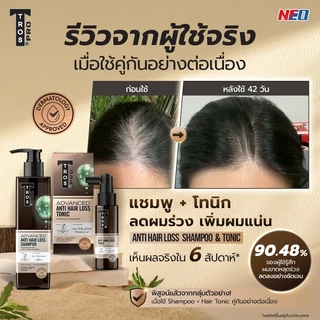 [เซตสุดคุ้ม] TROS โทนิคลดผมร่วง 70 มล. + แชมพูลดผมขาดหลุดร่วง 230 มล.