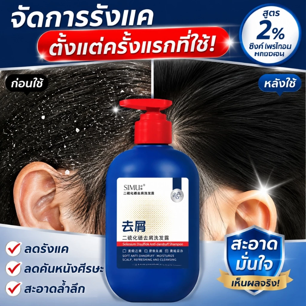แชมพูซีลีเนียมไดซัลไฟด์ 300ml ขจัดรังแคเชื้อราไรฝุ่น คุมความมัน ดูแลรูขุมขน ผมนุ่มฟูสดชื่นใช้ได้ทุกเพศ