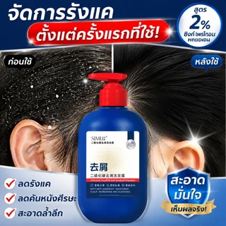 แชมพูซีลีเนียมไดซัลไฟด์ 300ml ขจัดรังแคเชื้อราไรฝุ่น คุมความมัน ดูแลรูขุมขน ผมนุ่มฟูสดชื่นใช้ได้ทุกเพศ