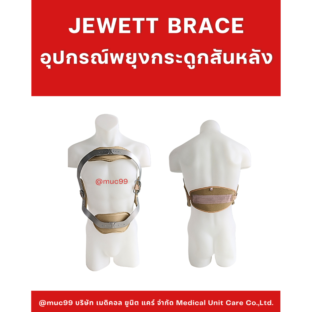 อุปกรณ์พยุงกระดูกสันหลัง (jewett brace เจเวท เบรซ)