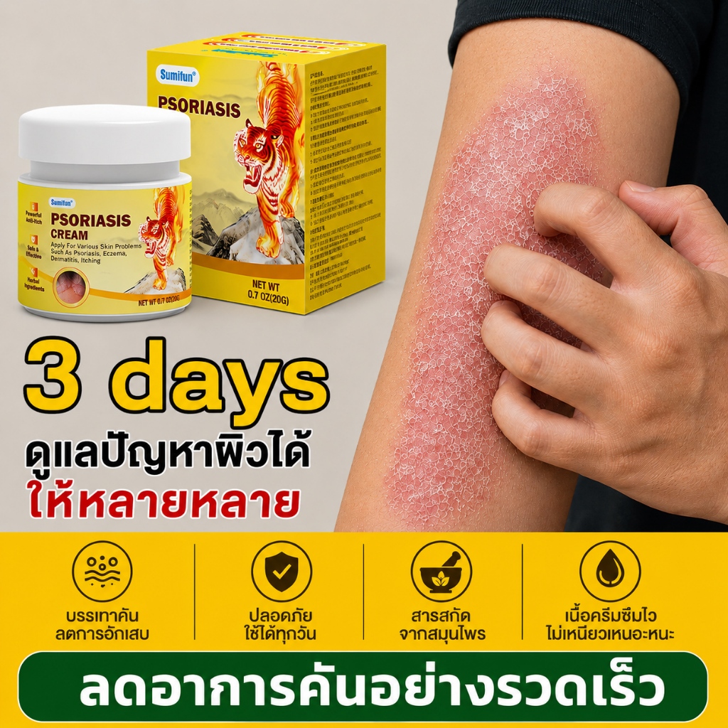 🔥[บอกลาอาการคันซ้ำ ๆ]🔥ครีมแก้คันขนาด บรรเทาอาการคัน เหมาะสำหรับปัญหาเชื้อรา เช่น กลาก เกลื้อน ใช้ได้ทั่วร่างกาย