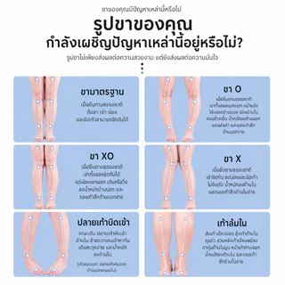 พื้นรองเท้า แก้ไขเท้าแบน และขารูปตัว O/X/XO รองรับอุ้งเท้าทั้งสูงและต่ำ ปรับรูปขาให้ตรง