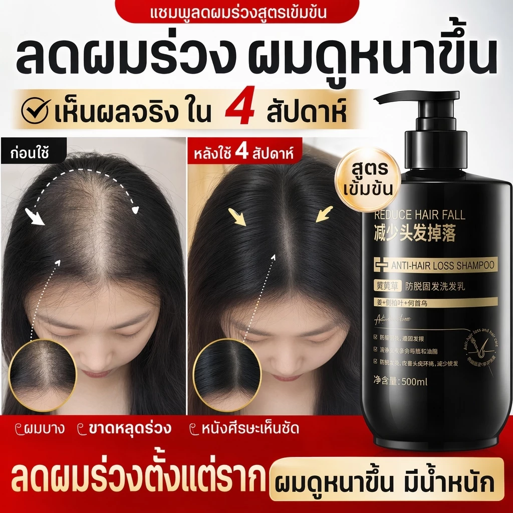 แชมพูขิงแก้ผมร่วง บำรุงรากผม ปรับปรุงสภาพเส้นผม เร่งผมยาว คืนคุณภาพเส้นผม